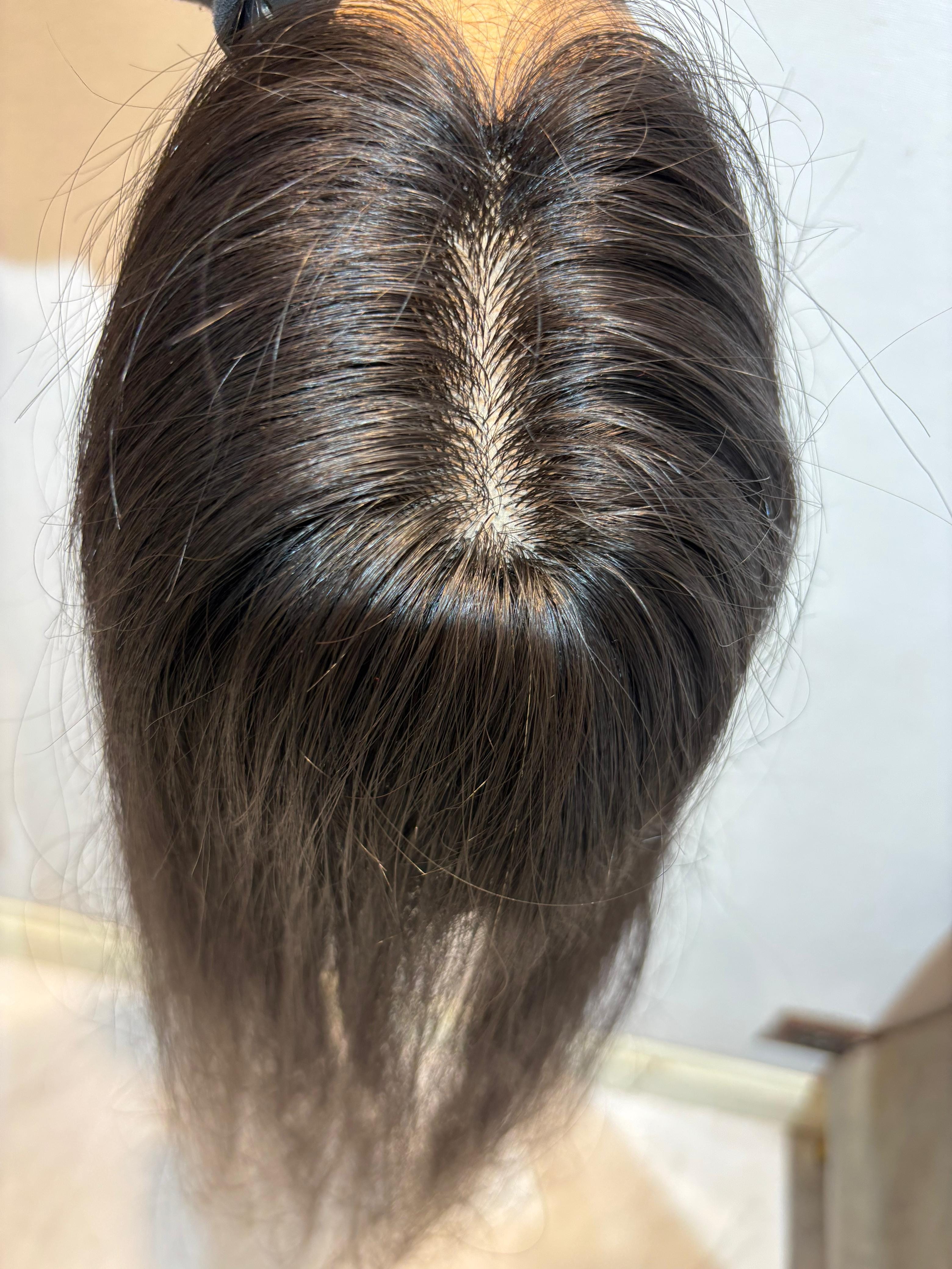 Hair Topper for Postpartum Hair Loss | Silk Base | Natural Black | Straight | Remy Hair India
